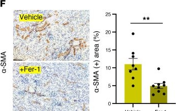 Fig.5.F showing Immunohistochemistry from the publication: Hepatocyte hedgehog signaling controls ferroptosis to alleviate aging-related organ dysfunction.