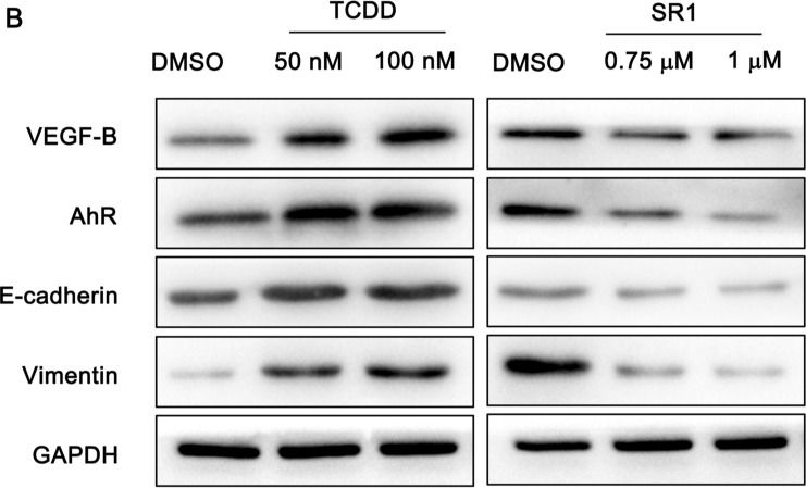 Fig.4.B showing Western Blotting from the publication: VEGF-B targeting by aryl hydrocarbon receptor mediates the migration and invasion of choriocarcinoma stem-like cells.