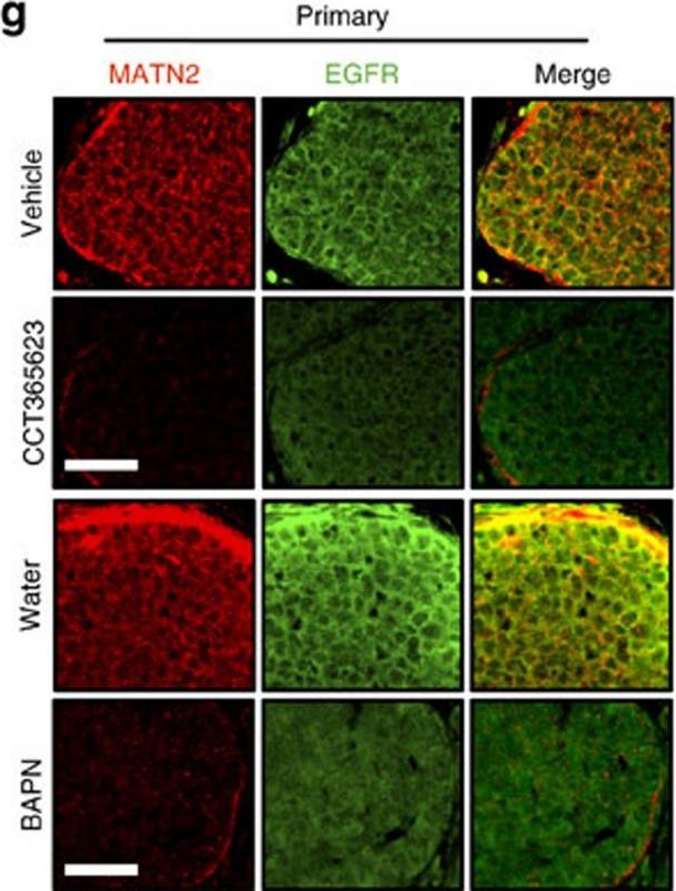 Fig.7.G showing Immunohistochemistry in a Mus musculus (House mouse) sample from the publication: Lysyl oxidase drives tumour progression by trapping EGF receptors at the cell surface.