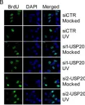 Fig.5.B showing Immunocytochemistry-immunofluorescence from the publication: HERC2/USP20 coordinates CHK1 activation by modulating CLASPIN stability.