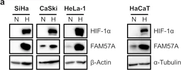 Fig.1.A showing Western Blotting from the publication: FAM57A (Family with Sequence Similarity 57 Member A) Is a Cell-Density-Regulated Protein and Promotes the Proliferation and Migration of Cervical Cancer Cells.