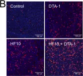 Fig.2.B showing Immunocytochemistry in a Mus musculus (House mouse) sample from the publication: Systemic CD8+ T cell-mediated tumoricidal effects by intratumoral treatment of oncolytic herpes simplex virus with the agonistic monoclonal antibody for murine glucocorticoid-induced tumor necrosis factor receptor.