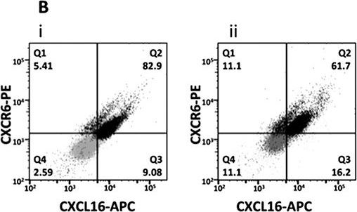 Fig.3.B showing Flow cytometry/Cell sorting in a Homo sapiens (Human) sample from the publication: CXCR6 expression in non-small cell lung carcinoma supports metastatic process via modulating metalloproteinases.
