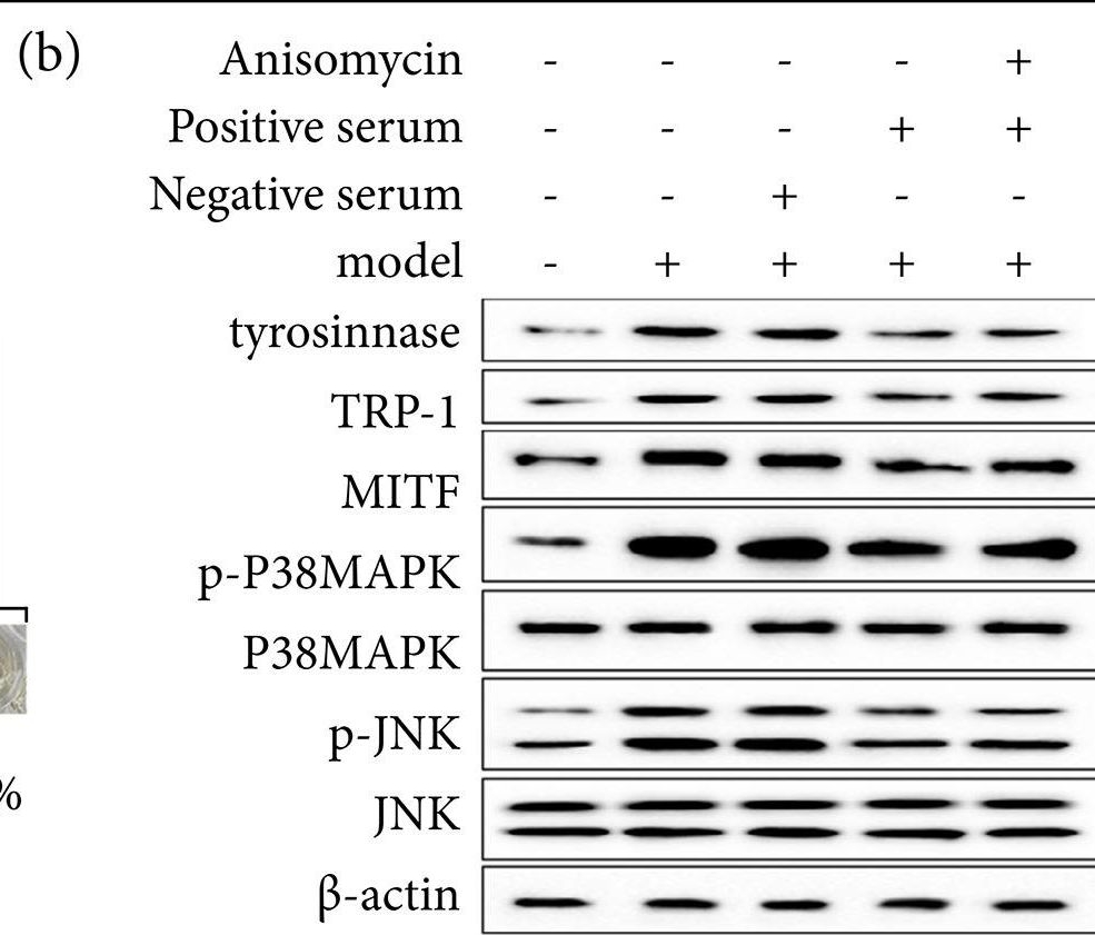 Fig.5.B showing Western Blotting from the publication: Licorice zinc suppresses melanogenesis via inhibiting the activation of P38MAPK and JNK signaling pathway in C57BL/6J mice skin.