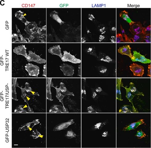 Fig.4.C showing Immunocytochemistry-immunofluorescence in a Homo sapiens (Human) sample from the publication: Ubiquitin-specific protease TRE17/USP6 promotes tumor cell invasion through the regulation of glycoprotein CD147 intracellular trafficking.