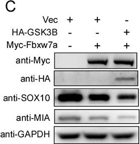 Fig.6.C showing Western Blotting from the publication: Regulation of SOX10 stability via ubiquitination-mediated degradation by Fbxw7α modulates melanoma cell migration.