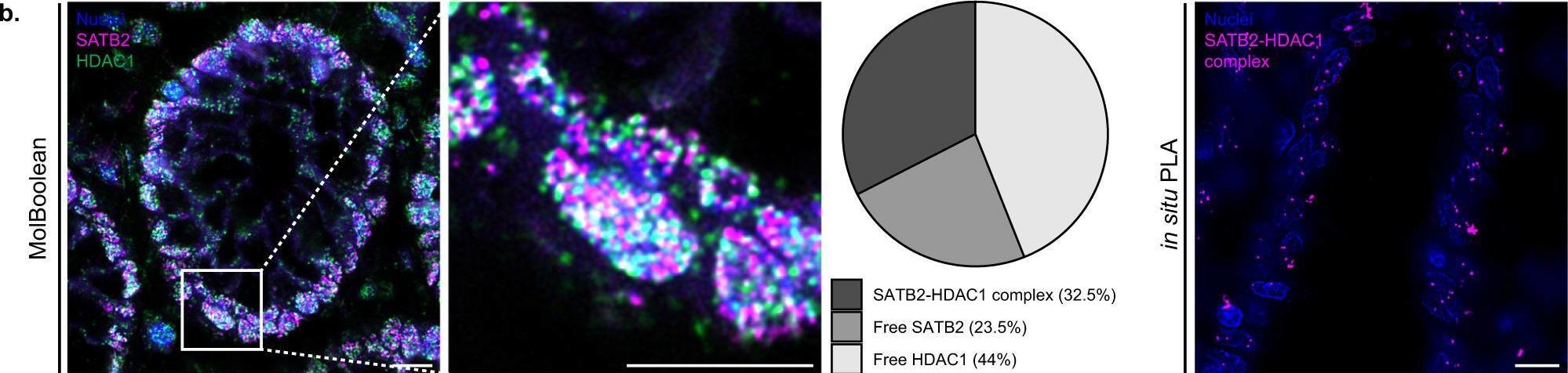 Fig.8.B showing Immunohistochemistry-immunofluorescence in a Homo sapiens (Human) sample from the publication: A method for Boolean analysis of protein interactions at a molecular level.