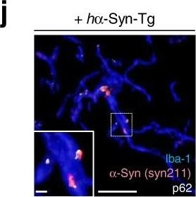 Microglia clear neuron-released α-synuclein via selective autophagy and prevent neurodegeneration.