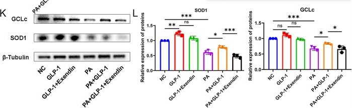 Fig.4.K from the publication: Inhibition of microRNA-139-5p by glucagon-like peptide-1 ameliorates oxidative stress-induced vascular endothelial cell damage via targeting SOD1/GCLc.