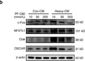 Fig.4.B showing Western Blotting from the publication: SphK1/mitophagy axis in cementocytes drives orthodontic root resorption via mitochondrial transfer to osteoclasts.
