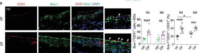 Fig.2.D showing Immunohistochemistry-immunofluorescence in a Mus musculus (House mouse) sample from the publication: Localized COUP-TFII pDNA Delivery Modulates Stem/Progenitor Cell Differentiation to Enhance Endothelialization and Inhibit Calcification of Decellularized Allografts.