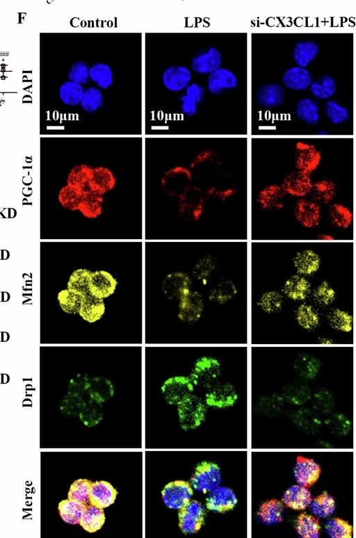 Fig.6.F showing Immunocytochemistry-immunofluorescence from the publication: CX3CL1 deficiency ameliorates acute kidney injury by inhibiting macrophage mitochondrial dysfunction and mtDNA-cGAS-STING signaling.