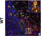 Fig.7.E showing Immunohistochemistry-immunofluorescence in a Mus musculus (House mouse) sample from the publication: IFN-gamma signaling in the central nervous system controls the course of experimental autoimmune encephalomyelitis independently of the localization and composition of inflammatory foci.