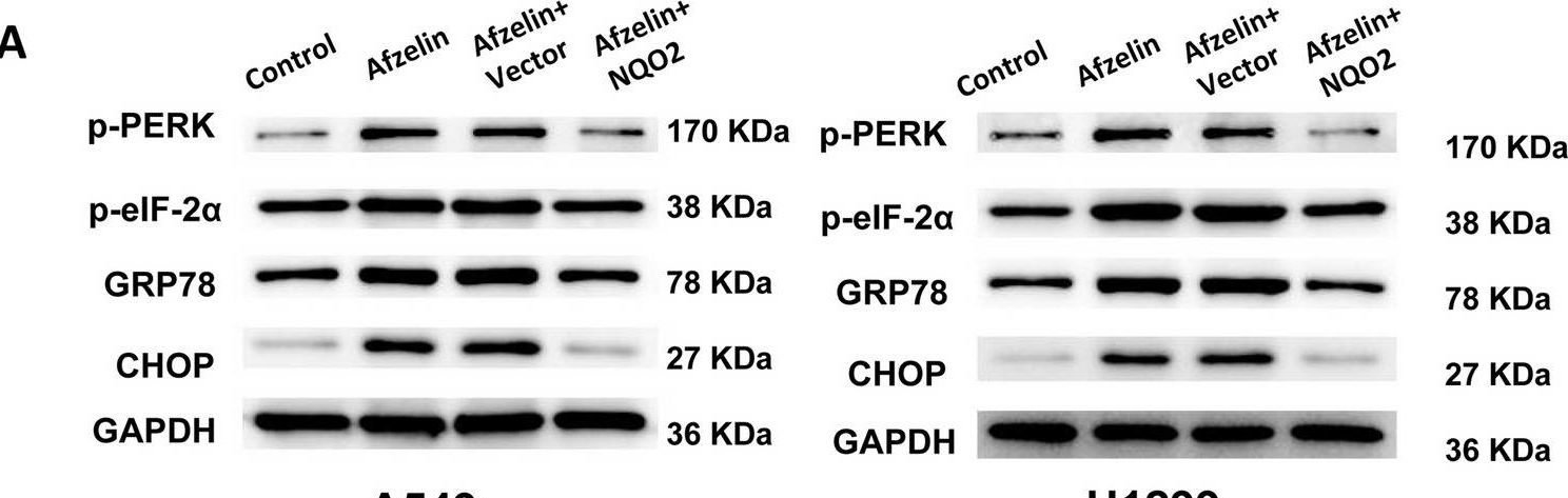 Fig.5.A showing Western Blotting in a Homo sapiens (Human) sample from the publication: Afzelin induces immunogenic cell death against lung cancer by targeting NQO2.