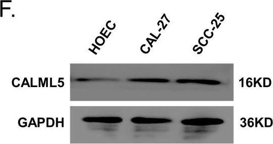 Fig.11.F showing Western Blotting from the publication: Head and neck squamous cell carcinoma-specific prognostic signature and drug sensitive subtypes based on programmed cell death-related genes.