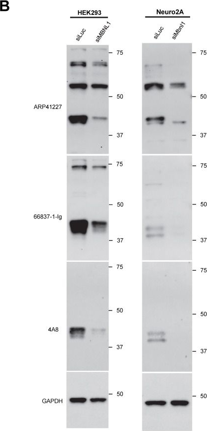 Fig.4.B showing Western Blotting in a Homo sapiens (Human) sample from the publication: Comparative Analysis of MBNL1 Antibodies: Characterization of Recognition Sites and Detection of RNA Foci Colocalization.