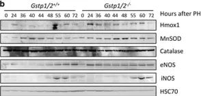 Fig.7.B showing Western Blotting in a Mus musculus (House mouse) sample from the publication: Glutathione transferases P1/P2 regulate the timing of signaling pathway activations and cell cycle progression during mouse liver regeneration.