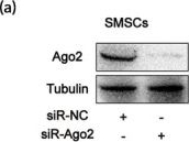Fig.6.A showing Western Blotting from the publication: Extracellular vesicles from glucocorticoids-preconditioned synovial mesenchymal stem cells exert antiarthritic effects by downregulating the mRNA m6A modification of NLRP3 in macrophages through miR-212-5p.