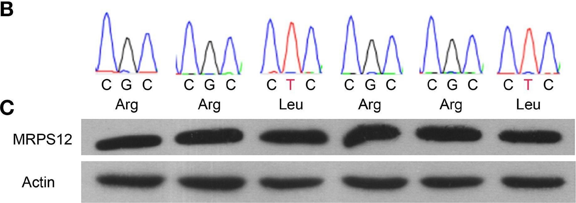 Fig.7.B showing Western Blotting from the publication: An MRPS12 mutation modifies aminoglycoside sensitivity caused by 12S rRNA mutations.