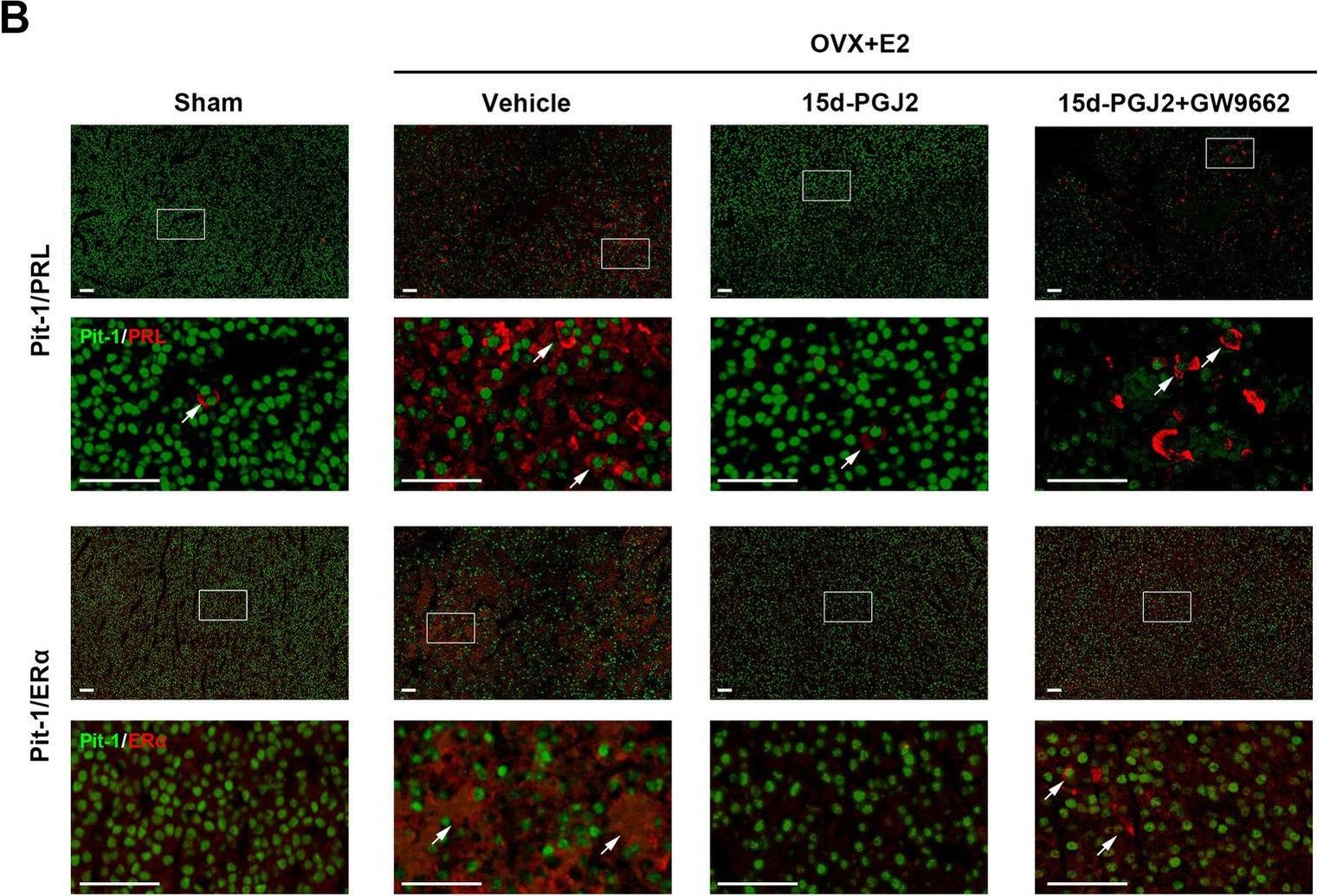 Fig.3.B showing Immunohistochemistry-immunofluorescence in a Rattus norvegicus (Rat) sample from the publication: Intranasal 15d-PGJ2 inhibits the growth of rat lactotroph pituitary neuroendocrine tumors by inducing PPARγ-dependent apoptotic and autophagic cell death.