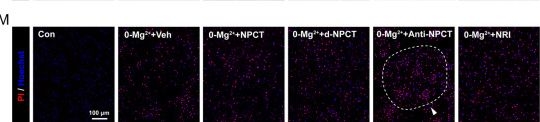Fig.5.V showing Immunohistochemistry-immunofluorescence from the publication: Aminoprocalcitonin protects against hippocampal neuronal death via preserving oxidative phosphorylation in refractory status epilepticus.