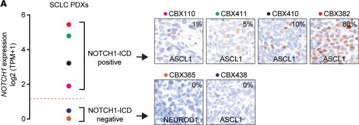 Fig.9.A showing Immunohistochemistry in a Homo sapiens (Human) sample from the publication: NOTCH1 reverses immune suppression in small cell lung cancer through reactivation of STING.