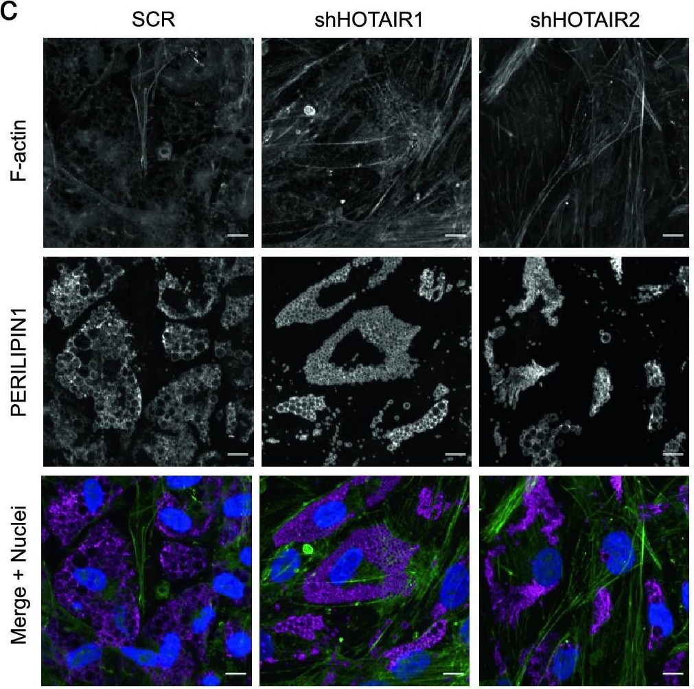 Long non-coding RNA HOTAIR regulates cytoskeleton remodeling and lipid storage capacity during adipogenesis.