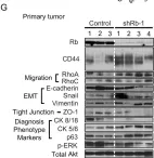 Fig.2.G showing Western Blotting from the publication: Rb suppresses collective invasion, circulation and metastasis of breast cancer cells in CD44-dependent manner.