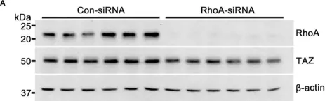 Fig.6.A showing Western Blotting in a Homo sapiens (Human) sample from the publication: TAZ is involved in breast cancer cell migration via regulating actin dynamics.