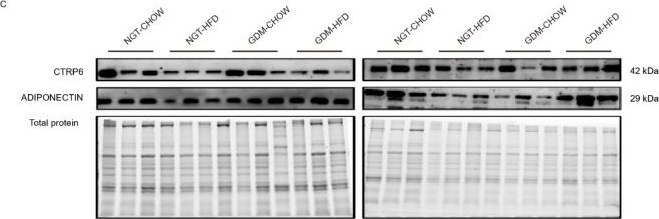 Fig.4.C showing Western Blotting from the publication: Maternal Gestational Diabetes Mellitus Modulates Adipose Tissue Remodeling and CTRP6 Expression in a Depot- and Sex-Specific Manner in Mouse Offspring.