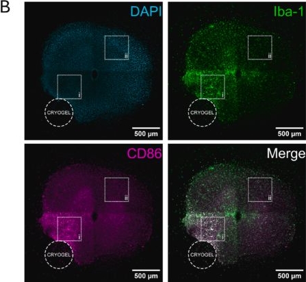 Fig.3.B showing Immunocytochemistry-immunofluorescence in a Mus musculus (House mouse) sample from the publication: Cryogel scaffolds for localised delivery of lipopolysaccharide in organotypic spinal cord slice cultures: A novel ex vivo model of neuroinflammation.