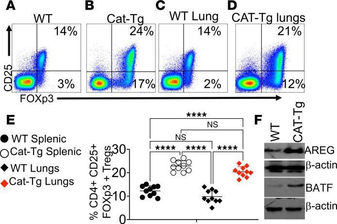 Fig.5.A showing Flow cytometry/Cell sorting in a Mus musculus (House mouse) sample from the publication: β-Catenin stabilization protects against alveolar hemorrhage through amphiregulin- and BATF-mediated Tregs.