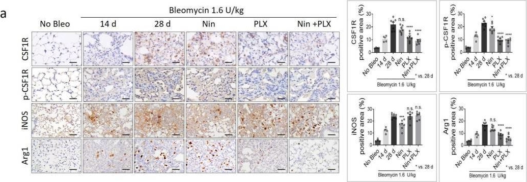 Fig.6.A showing Immunohistochemistry in a Mus musculus (House mouse) sample from the publication: Pexidartinib and Nintedanib Combination Therapy Targets Macrophage Polarization to Reverse Pulmonary Fibrosis: A Preclinical Study.