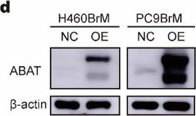 Fig.4.D showing Western Blotting in a Homo sapiens (Human) sample from the publication: GABA regulates metabolic reprogramming to mediate the development of brain metastasis in non-small cell lung cancer.