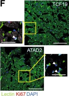 Fig.7.F showing Immunohistochemistry-immunofluorescence in a Mus musculus (House mouse) sample from the publication: Downregulation of TCF19 and ATAD2 causes endothelial cell cycle arrest at the transition from cardiac hypertrophy to heart failure.