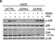 Fig.1.D showing Western Blotting from the publication: Ribosome stalling is a signal for metabolic regulation by the ribotoxic stress response.