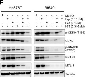 Fig.2.F showing Western Blotting from the publication: Disrupting CDK9 activity suppresses triple-negative breast cancer and is enhanced by EGFR Inhibition.
