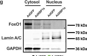 Fig.1.G showing Western Blotting from the publication: Xbp1s-FoxO1 axis governs lipid accumulation and contractile performance in heart failure with preserved ejection fraction.