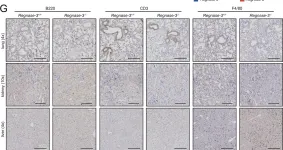Fig.2.G showing Immunohistochemistry from the publication: Immune homeostasis and regulation of the interferon pathway require myeloid-derived Regnase-3.