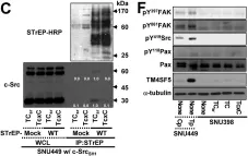 Fig.6.C showing Western Blotting from the publication: N-terminus-independent activation of c-Src via binding to a tetraspan(in) TM4SF5 in hepatocellular carcinoma is abolished by the TM4SF5 C-terminal peptide application.