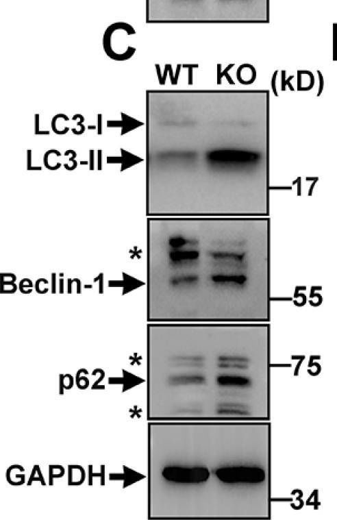 Fig.4.C showing Western Blotting from the publication: Trappc9 Deficiency Impairs the Plasticity of Stem Cells.