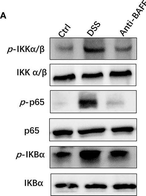 Fig.5.A showing Western Blotting in a Mus musculus (House mouse) sample from the publication: BAFF Blockade Attenuates DSS-Induced Chronic Colitis via Inhibiting NLRP3 Inflammasome and NF-κB Activation.