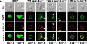 Fig.4.A showing Immunocytochemistry-immunofluorescence in a Homo sapiens (Human) sample from the publication: Ezrin/Radixin/Moesin proteins and flotillins cooperate to promote uropod formation in T cells.