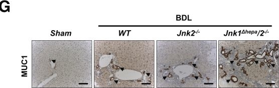 Fig.6.G showing Immunohistochemistry from the publication: Differential Protective Roles of c-Jun N-terminal Kinase-2 in Nonparenchymal Liver Cells and Hepatocytes During Cholestasis.