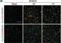 Fig.4.B showing Immunohistochemistry-immunofluorescence in a Mus musculus (House mouse) sample from the publication: Selective brain hypothermia attenuates focal cerebral ischemic injury and improves long-term neurological outcome in aged female mice.