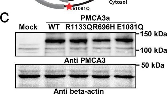 Fig.1.C showing Western Blotting in a Homo sapiens (Human) sample from the publication: The ataxia-linked E1081Q mutation affects the sub-plasma membrane Ca2+-microdomains by tuning PMCA3 activity.