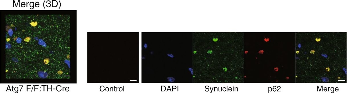 Loss of autophagy in dopaminergic neurons causes Lewy pathology and motor dysfunction in aged mice.