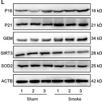 Fig.6.L showing Western Blotting from the publication: Cigarette Smoke-Induced Alveolar Macrophage Senescence via GEM/SIRT3-Mediated Mitochondrial Dysfunction.