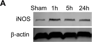 Fig.7.A showing Western Blotting from the publication: The chronic protective effects of limb remote preconditioning and the underlying mechanisms involved in inflammatory factors in rat stroke.