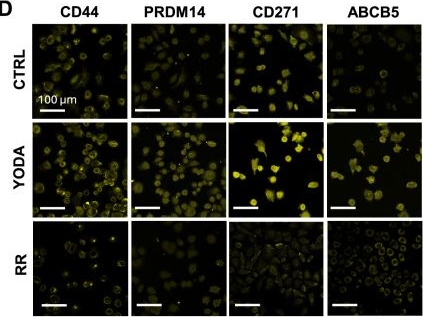 Fig.4.D showing Immunocytochemistry-immunofluorescence in a Homo sapiens (Human) sample from the publication: Capillary constrictions prime cancer cell tumorigenicity through PIEZO1.